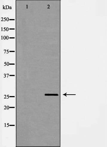 HDGF Antibody