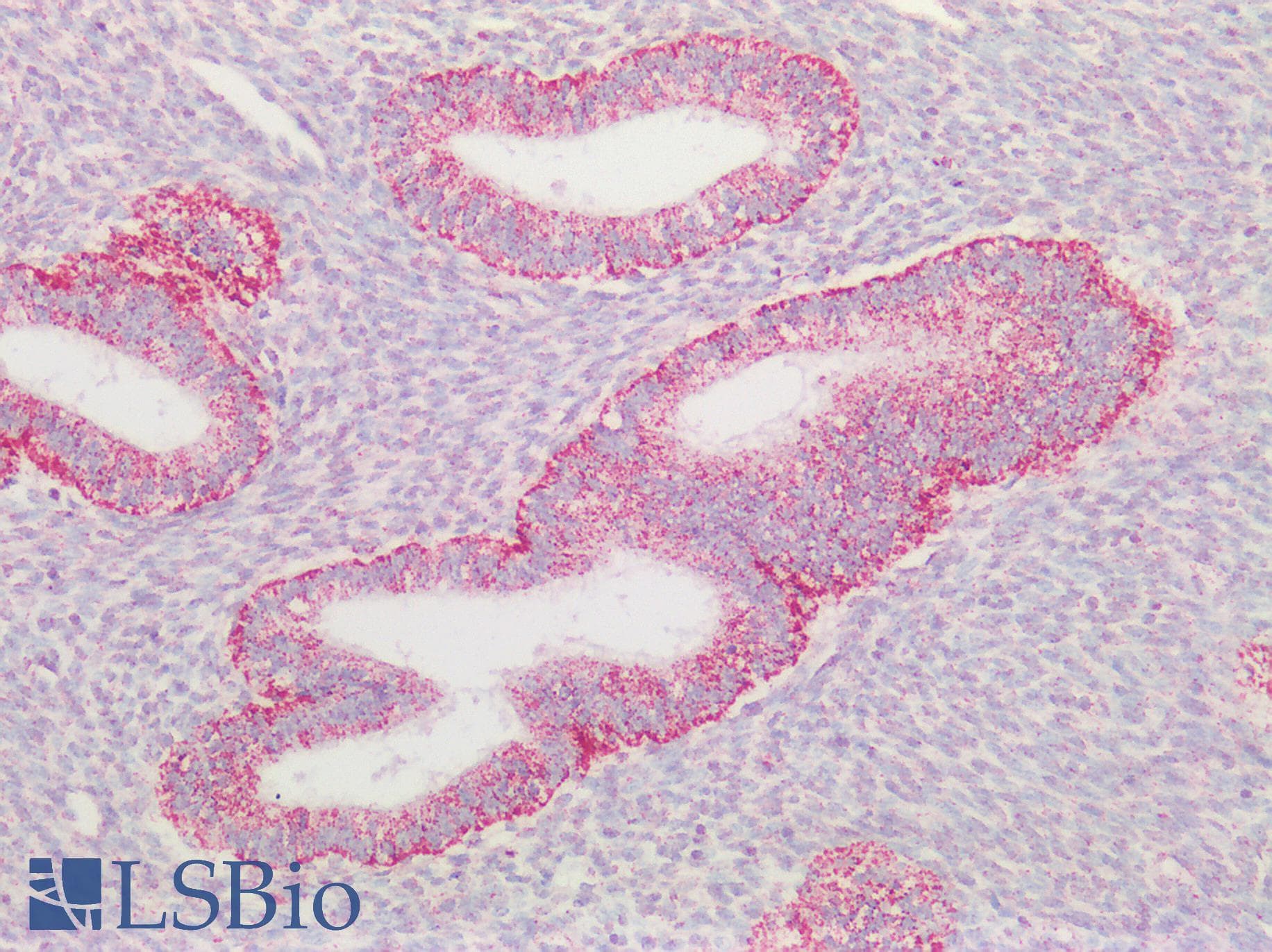 PathPlus™ HSPD1 / HSP60 Antibody