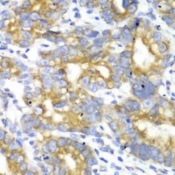 MtTFA / TFAM Antibody
