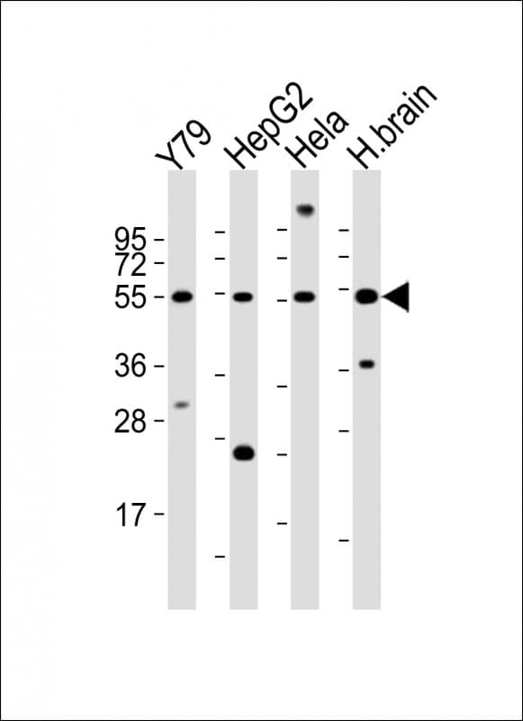FOXN4 Antibody (aa436-470)