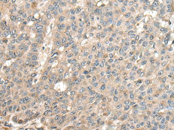 CASQ1 / Calsequestrin 1 Antibody