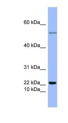 GCG / Glucagon Antibody (aa107-156)