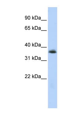 MNX1 / HB9 Antibody (aa36-85)