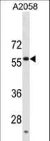 USP14 Antibody (aa355-383)