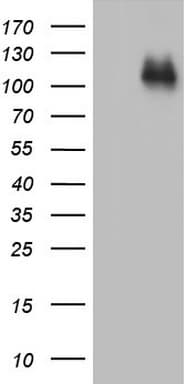 IHC-plus™ CDH4 / R Cadherin Antibody (aa170-428, clone 6H5)