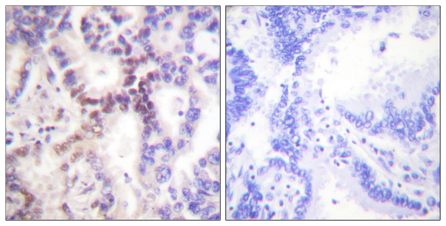 CDKN2B / p15 INK4b Antibody (aa89-138)