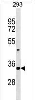 HOXD9 Antibody (aa125-152)
