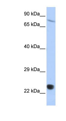 SP110 Antibody (aa612-661)