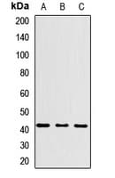Polyclonal Rabbit anti-Human HLA-C Antibody (WB)