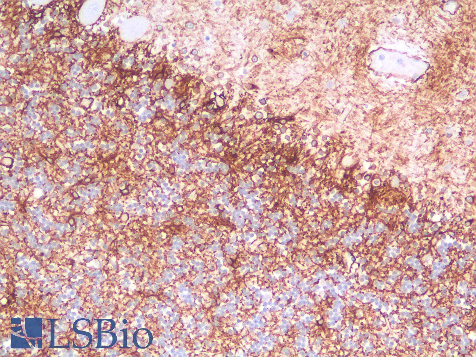 PathPlus™ GFAP Antibody (clone rASTRO/789)