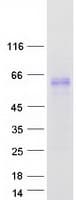Human FGL2 Protein (Recombinant Myc-DDK (Flag))