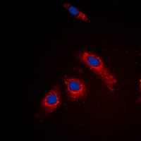 RPL3L Antibody (Internal)