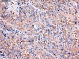 TRIM33 / TIF1-Gamma Antibody (clone OTI6B7)