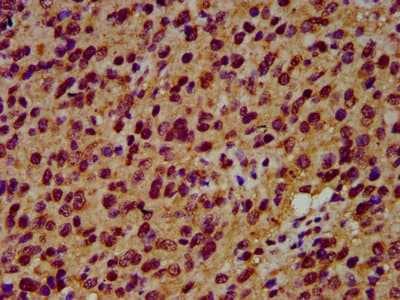 Polyclonal Rabbit anti-Human SIAH2 Antibody (IHC, IF)