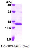 Human SAA4 Protein (Recombinant His)