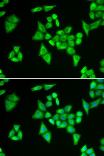 ADSL / Adenylosuccinate Lyase Antibody
