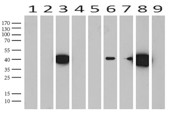 Monoclonal Mouse anti-Human KRT19 / CK19 / Cytokeratin 19 Antibody (clone UMAB188, aa240-390, IHC, IF, WB)