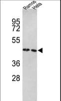 EFTU / TUFM Antibody (aa75-104)