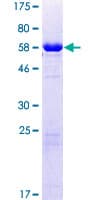 Human CHMP6 Protein (Recombinant GST)