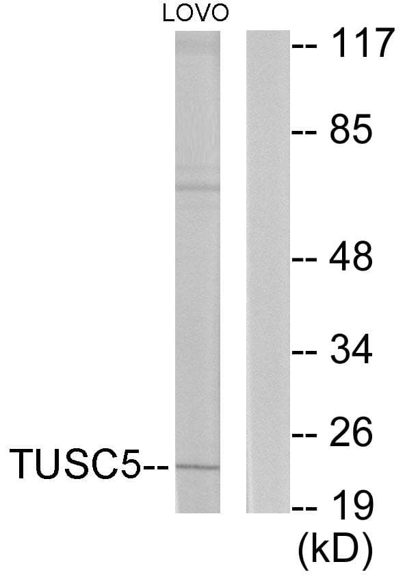 TUSC5 Antibody