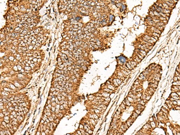 Polyclonal Rabbit anti-Human ATP5I Antibody (IHC, WB)