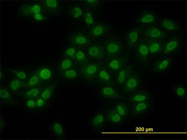 IHC-plus™ HMG1 / HMGB1 Antibody (clone 2F6)
