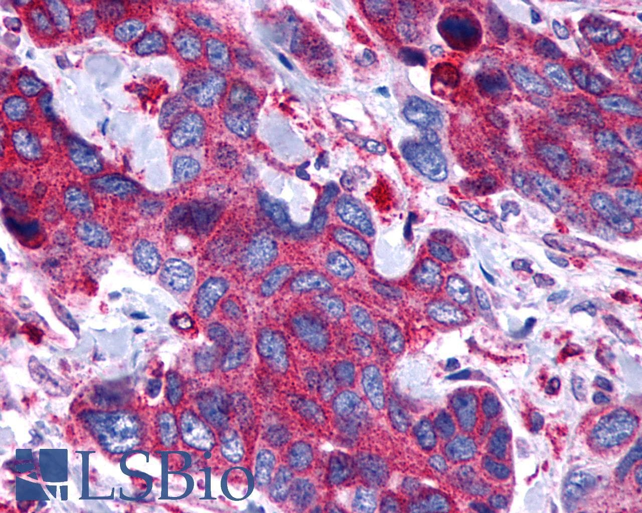 PathPlus™ Polyclonal Rabbit anti-Human PTGER4 / EP4 Antibody (C-Terminus, IHC)