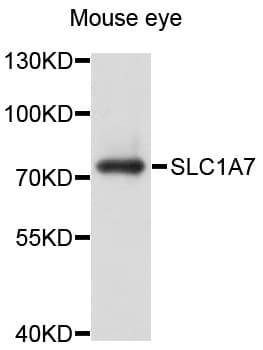 Polyclonal Rabbit anti-Human SLC1A7 / EAAT5 Antibody (WB)