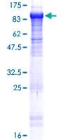 Human KLHL22 Protein (Recombinant GST)