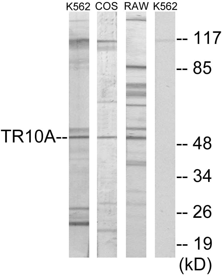 Polyclonal Rabbit anti-Human TNFRSF10A / DR4 Antibody (aa401-450, WB)