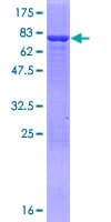 Human AMDHD2 Protein (Recombinant GST)