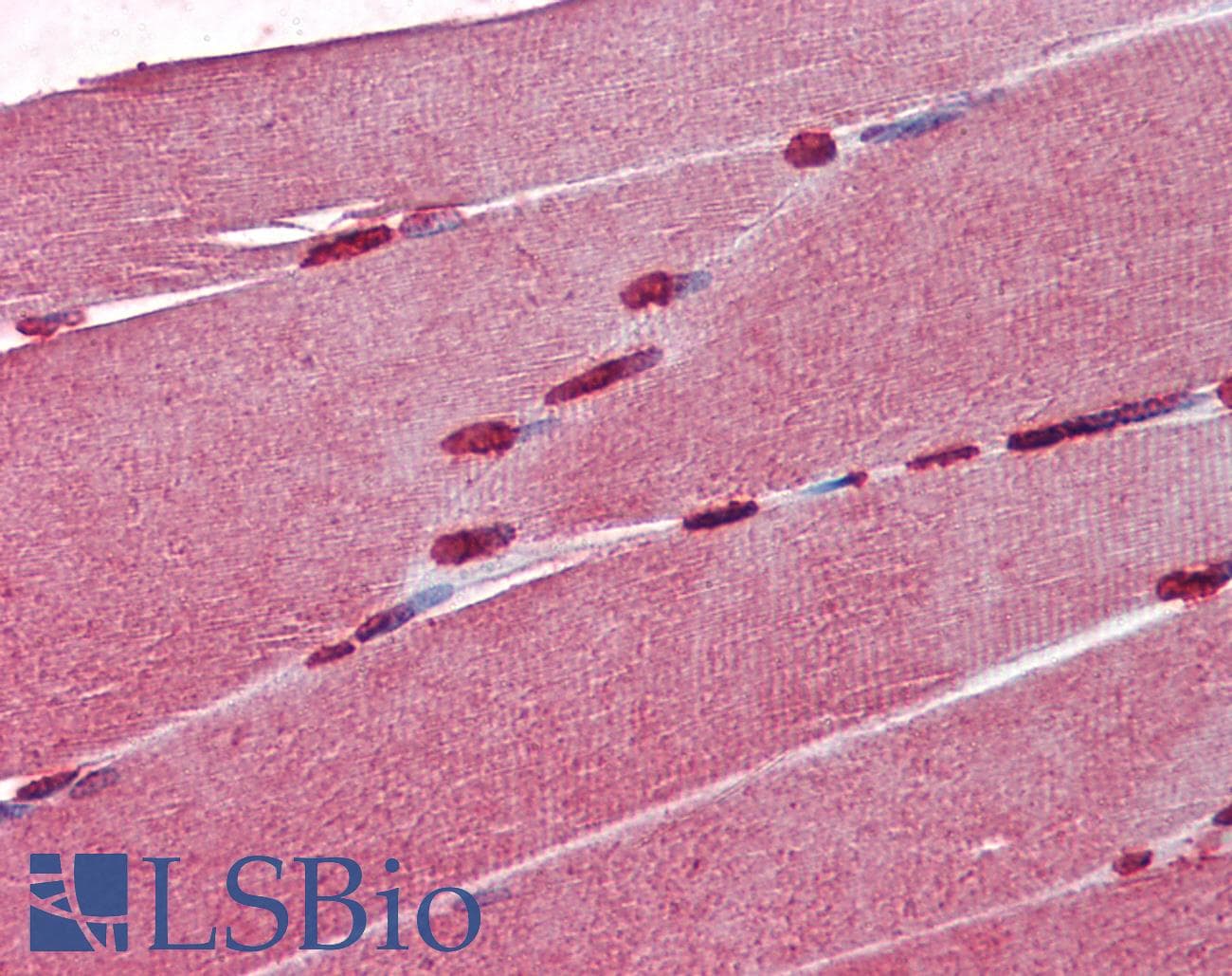 IHC-plus™ Monoclonal Mouse anti-Human CRABP1 / CRABP Antibody (clone AT1A1, IHC, WB)