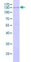 Human RIP4 / ANKRD3 Protein (Recombinant GST)