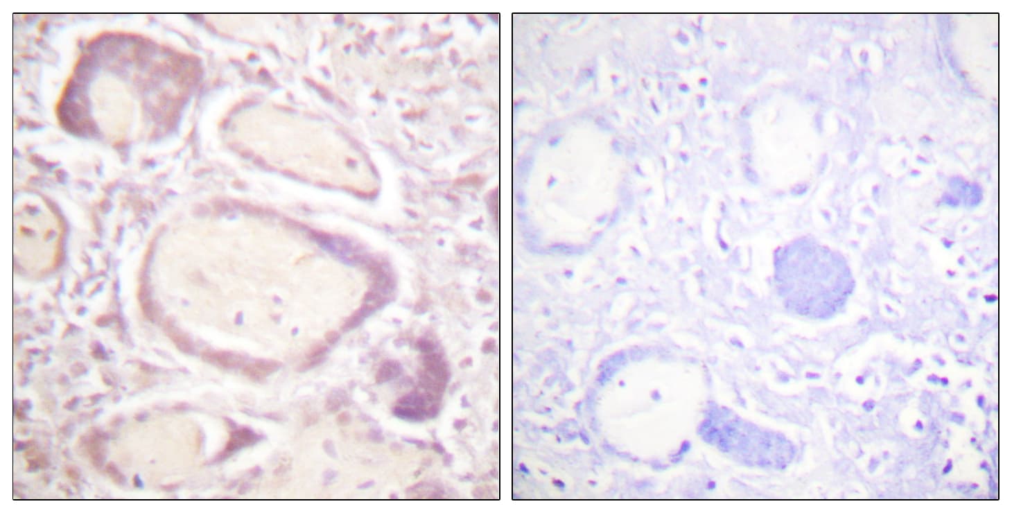 CCNB1 / Cyclin B1 Antibody (phospho-Ser147)