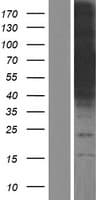 CALCOCO1 / CoCoa Protein (Over-Expression Lysate Myc-DDK (Flag))