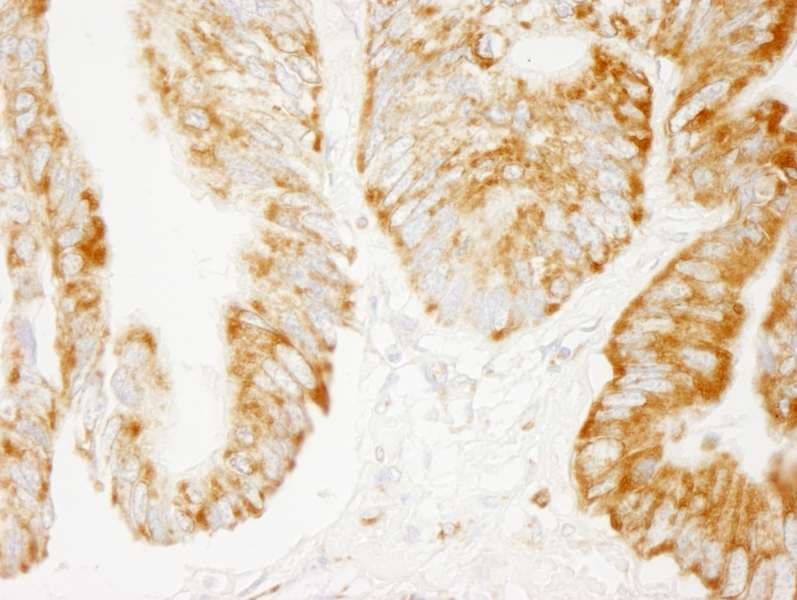 Polyclonal Rabbit anti-Human COXIV / COX4 Antibody (aa25-75, IHC, WB)