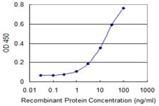 Monoclonal Mouse anti-Human ALDH18A1 Antibody (clone 2B5, WB)