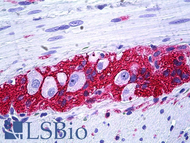IHC-plus™ Monoclonal Mouse anti-Human NCAM / CD56 Antibody (clone 123C3, Concentrated, IHC, IF)