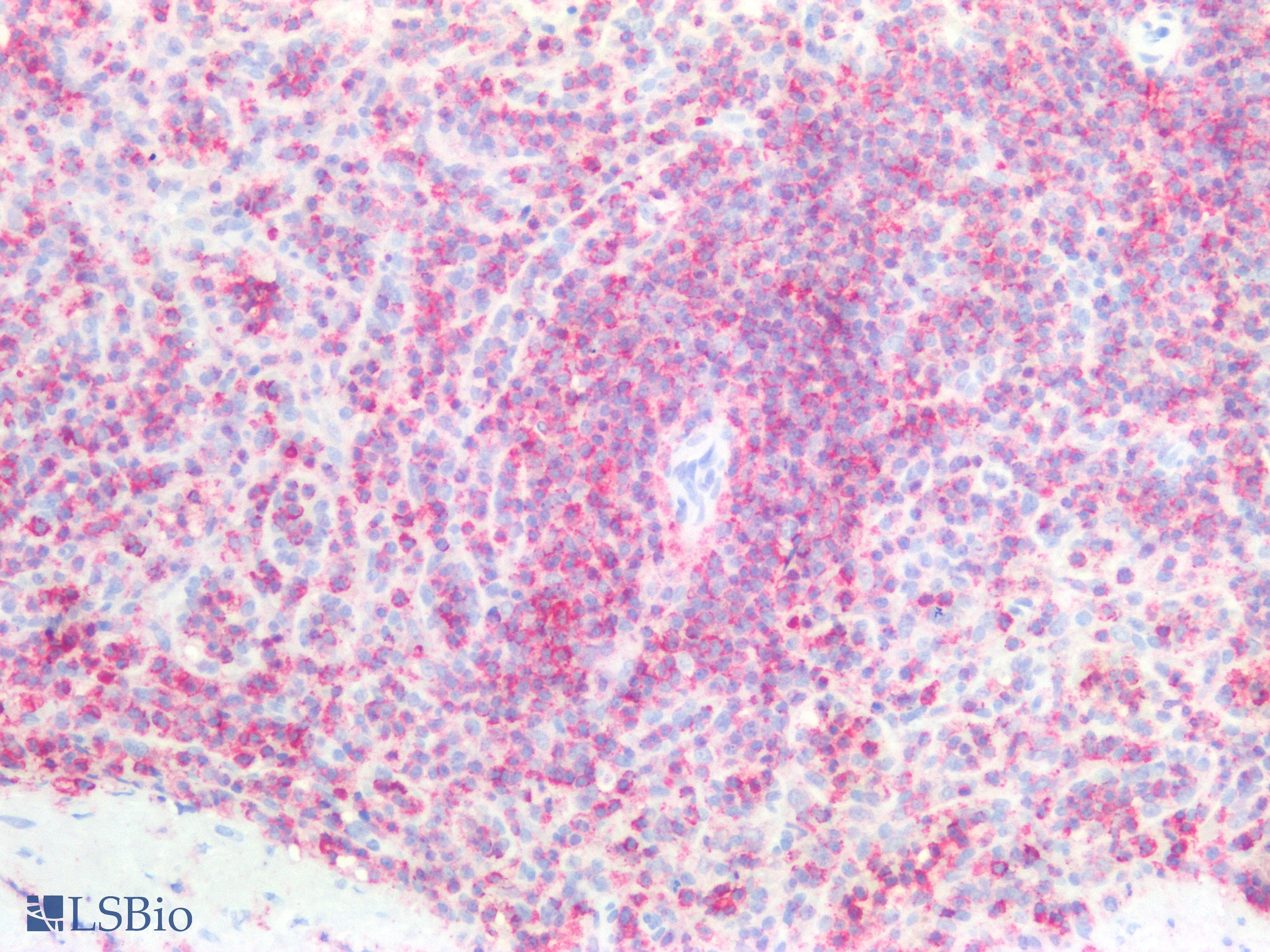 Monoclonal Mouse anti-Human CD45 / LCA Antibody (clone MEM-28, IHC, WB)