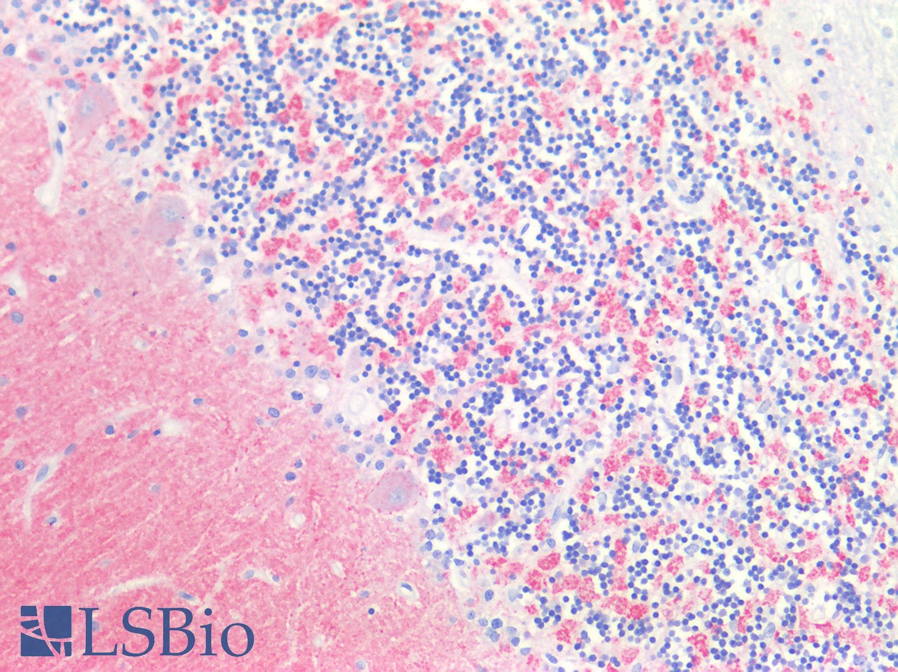 IHC-plus™ SYP / Synaptophysin Antibody