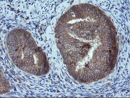 MMACHC Antibody (clone OTI1A4)