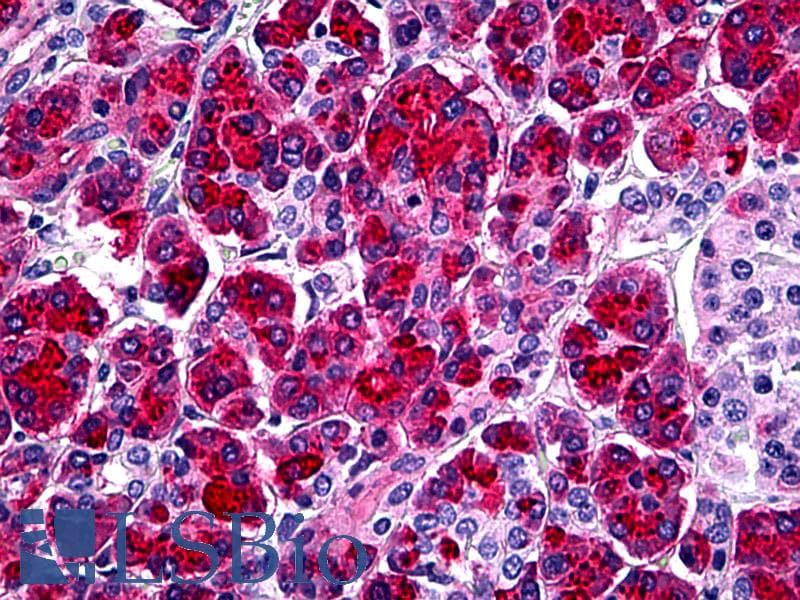IHC-plus™ SPINK1 Antibody (clone 4D4)