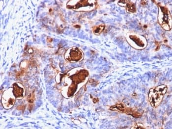 CEA / Carcinoembryonic Antigen Antibody (clone C66/1260, Ready-to-Use)
