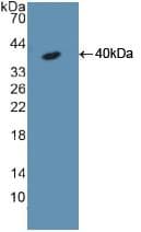 KRT18 / CK18 / Cytokeratin 18 Antibody (aa72-380)