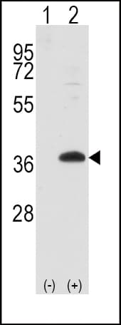 Polyclonal Rabbit anti-Human FRAT1 Antibody (aa99-128, IHC, WB)
