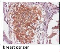 Polyclonal Rabbit anti-Human SLC38A2 / SNAT2 Antibody (IHC, WB)
