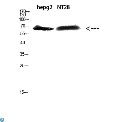 Polyclonal Rabbit anti-Human ZFP91 Antibody (WB)
