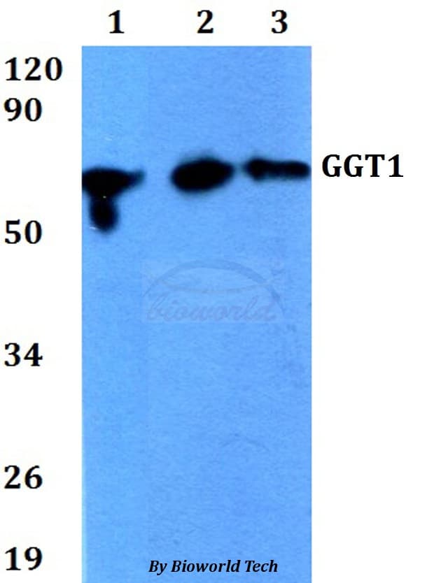 GGT1 / GGT Antibody