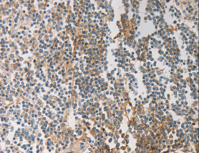 PRMT5 Antibody