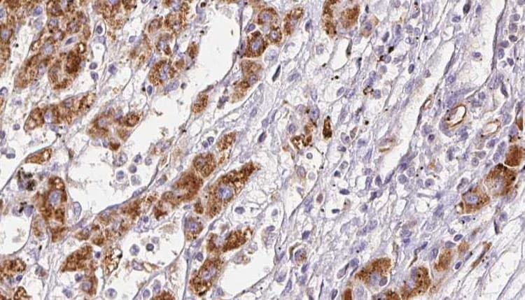 AGTR2 / AT2 Receptor Antibody